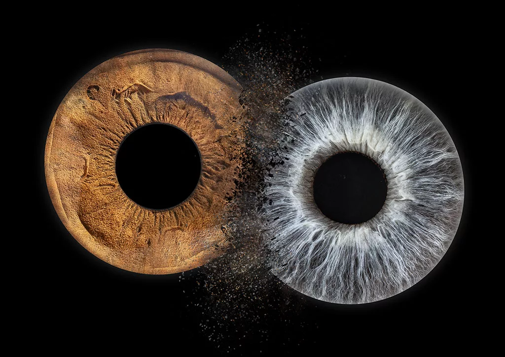 photo iris geneve - deux yeux brun et bleu explosion sur fond noir